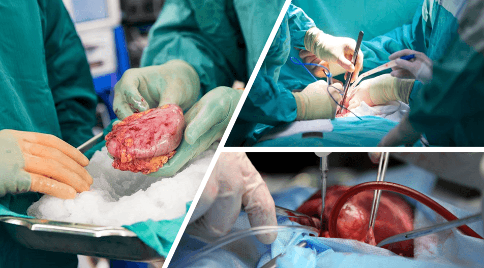 Quản lý người nhận ghép tạng đặc trong HSCC